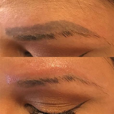 Eyebrow tattoo removal. Things To Know About Eyebrow tattoo removal. 